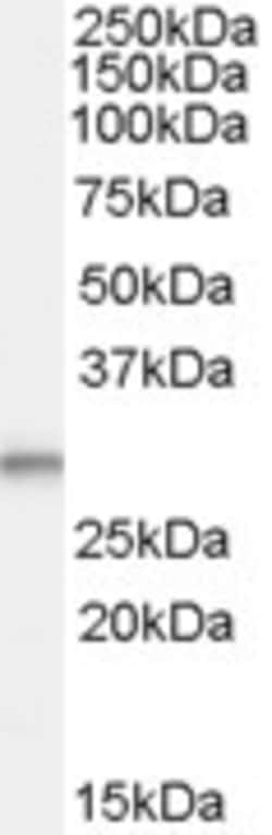 Invitrogen TPD52L2 Polyclonal Antibody 100 &mu;g; Unconjugated:Antibodies,