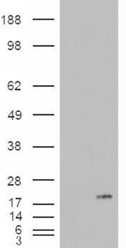PLA2 Polyclonal Antibody 100 &mu;g | Buy Online | Thermo Scientific | Fisher Scientific