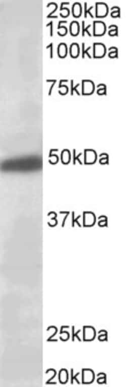 Invitrogen Kir3.2 (KCNJ6) Polyclonal Antibody 100 &mu;g; Unconjugated:Antikroppar