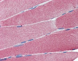 Invitrogen CADM4 Polyclonal Antibody 100 &mu;g | Buy Online | Invitrogen&trade; | Fisher Scientific