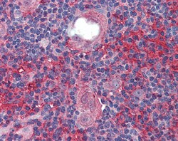 Invitrogen CADM4 Polyclonal Antibody 100 &mu;g | Buy Online | Invitrogen&trade; | Fisher Scientific