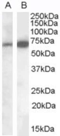 Invitrogen CADM4 Polyclonal Antibody 100 &mu;g | Buy Online | Invitrogen&trade; | Fisher Scientific