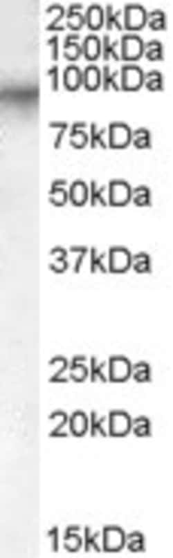 Factor XIII A Polyclonal Antibody 100 &mu;g | Buy Online | Invitrogen | Fisher Scientific