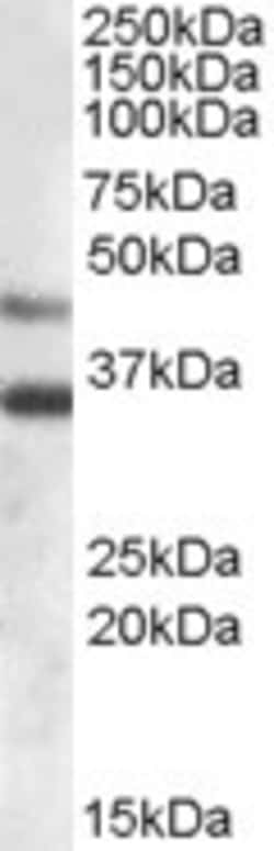 Invitrogen Arylsulfatase B Polyclonal Antibody 100 &mu;g | Buy Online | Invitrogen&trade; | Fisher Scientific
