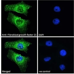 Invitrogen FGF21 Polyclonal Antibody 100 &mu;g; Unconjugated:Antibodies,
