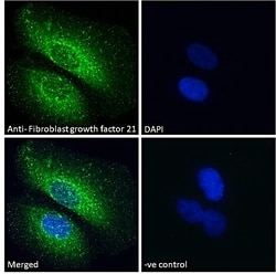 Invitrogen FGF21 Polyclonal Antibody 100 &mu;g; Unconjugated:Antibodies,