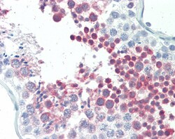 MEPCE Polyclonal Antibody:Antibodies, Polyclonal