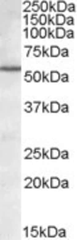 Invitrogen BAG5 Polyclonal Antibody 100 &mu;g; Unconjugated:Antibodies,