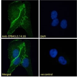 Invitrogen EPB41L2 Polyclonal Antibody 100 &mu;g; Unconjugated:Antibodies,