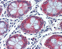 Invitrogen EPB41L2 Polyclonal Antibody 100 &mu;g; Unconjugated:Antibodies,