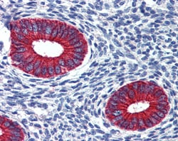 Invitrogen EPB41L2 Polyclonal Antibody 100 &mu;g; Unconjugated:Antibodies,