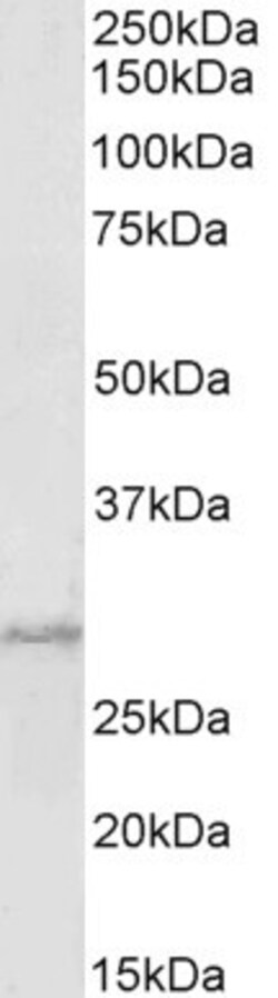 Invitrogen PRRX1 Polyclonal Antibody 100 &mu;g; Unconjugated:Antibodies,