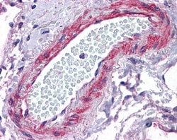 Invitrogen CRP2 Polyclonal Antibody 100 &mu;g; Unconjugated:Antibodies,