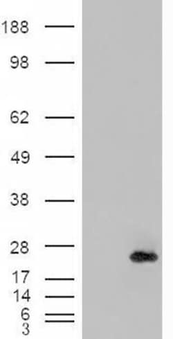 Invitrogen CRP2 Polyclonal Antibody 100 &mu;g; Unconjugated:Antibodies,