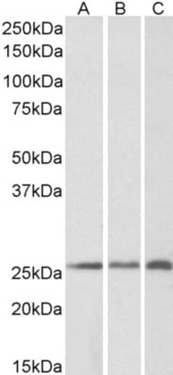 Invitrogen CRP2 Polyclonal Antibody 100 &mu;g; Unconjugated:Antibodies,
