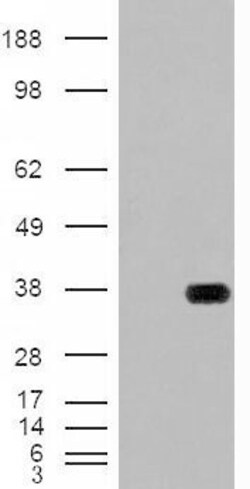 HADH Polyclonal Antibody:Antibodies, Polyclonal