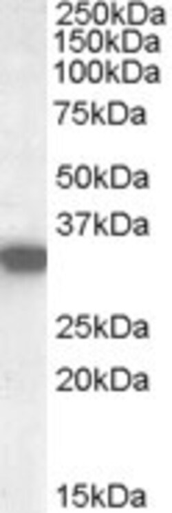HADH Polyclonal Antibody:Antibodies, Polyclonal