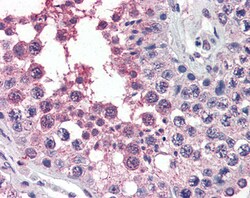 Invitrogen ACVR1 Polyclonal Antibody 100 &mu;g; Unconjugated:Antikroppar