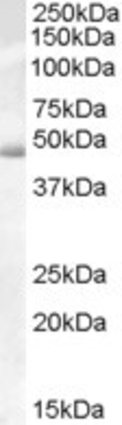 Invitrogen Actin-like 7B Polyclonal Antibody 100 &mu;g; Unconjugated:Antibodies,