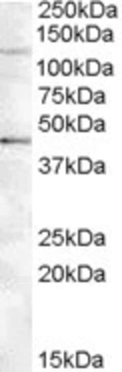 Invitrogen Tankyrase 2 Polyclonal Antibody 100 &mu;g; Unconjugated:Antibodies,