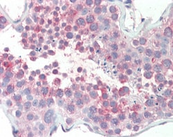 Invitrogen MARCH10 Polyclonal Antibody 100 &mu;g; Unconjugated:Antibodies,