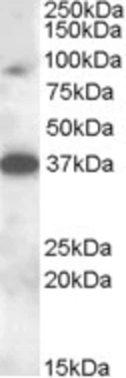 Invitrogen MARCH10 Polyclonal Antibody 100 &mu;g; Unconjugated:Antibodies,