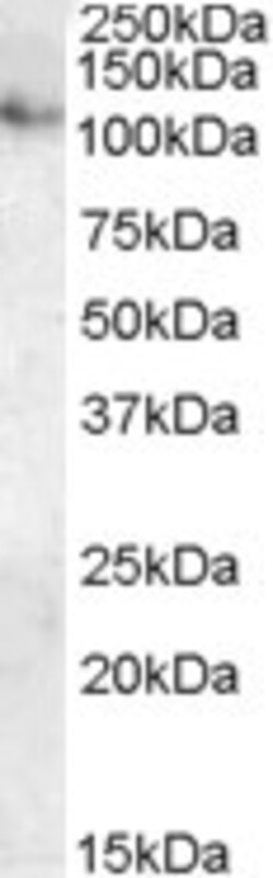 Invitrogen ATP13A1 Polyclonal Antibody 100 &mu;g; Unconjugated:Antibodies,