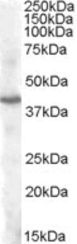 Invitrogen PITX3 Polyclonal Antibody 100 &mu;g; Unconjugated:Antibodies,
