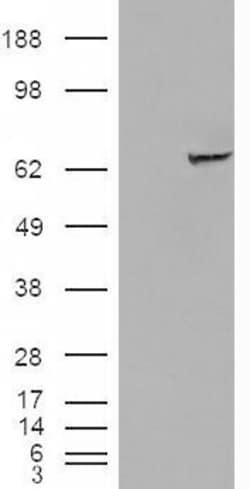 Invitrogen IGF2BP2 Polyclonal Antibody 100 &mu;g | Buy Online | Invitrogen&trade; | Fisher Scientific