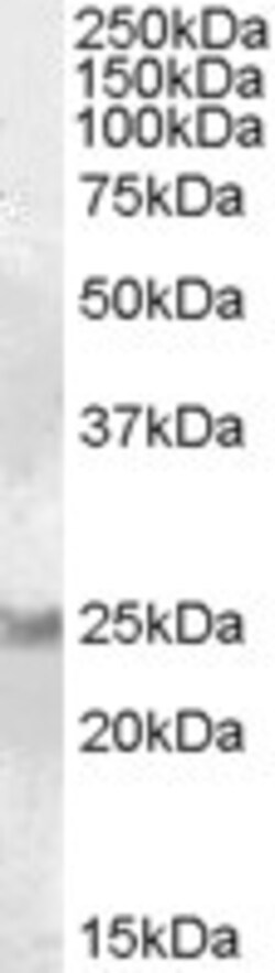 Invitrogen RAB8A Polyclonal Antibody 100 &mu;g; Unconjugated:Antibodies,