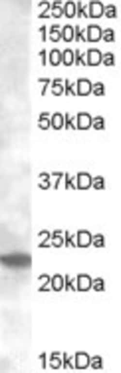 Invitrogen RAB17 Polyclonal Antibody 100 &mu;g; Unconjugated:Antibodies,