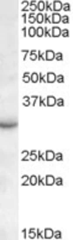 Invitrogen RAB23 Polyclonal Antibody 100 &mu;g; Unconjugated:Antibodies,