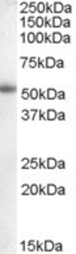 Invitrogen Aromatase Polyclonal Antibody 100 &mu;g; Unconjugated:Antibodies,