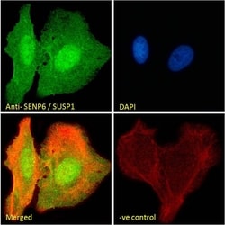Invitrogen SENP6 Polyclonal Antibody 100 &mu;g; Unconjugated:Antibodies,
