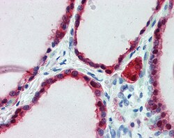 Invitrogen Frizzled-2 Polyclonal Antibody 100 μg; Unconjugated:Antibodies,