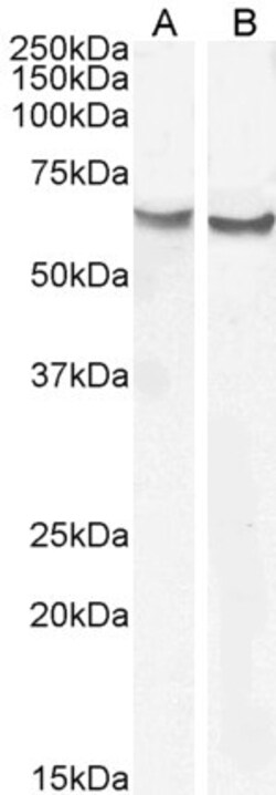 Invitrogen Frizzled-2 Polyclonal Antibody 100 μg; Unconjugated:Antibodies,