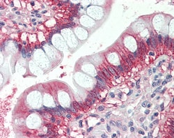 Invitrogen N-Ras Polyclonal Antibody 100 μg; Unconjugated:Antibodies,