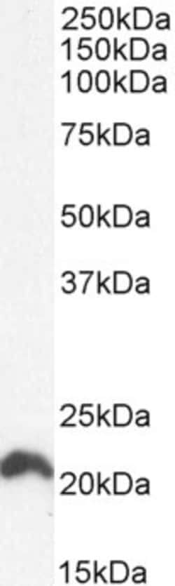 Invitrogen N-Ras Polyclonal Antibody 100 μg; Unconjugated:Antibodies,