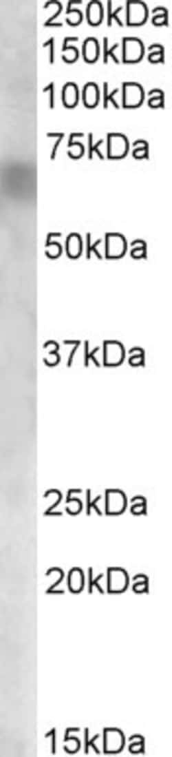 Invitrogen RPE65 Polyclonal Antibody 100 &mu;g; Unconjugated:Antibodies,