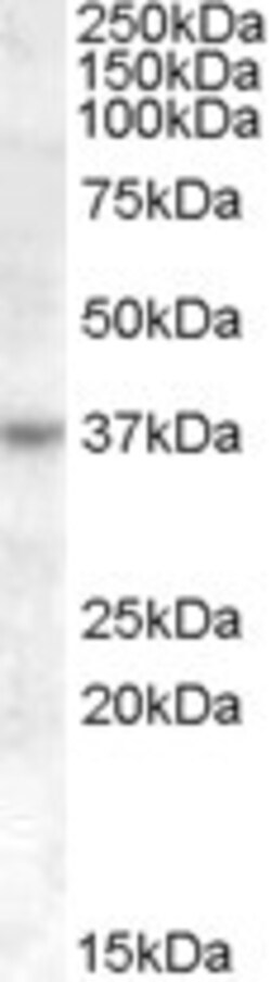 Invitrogen RASSF7 Polyclonal Antibody 100 &mu;g; Unconjugated:Antibodies,