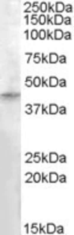 Invitrogen RASSF8 Polyclonal Antibody 100 &mu;g; Unconjugated:Antibodies,