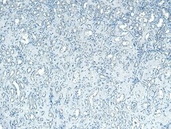 Invitrogen PNPLA3 Polyclonal Antibody 100 &mu;g; Unconjugated:Antibodies,