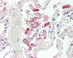 Invitrogen CES1 Polyclonal Antibody 100 &mu;g; Unconjugated:Antibodies,