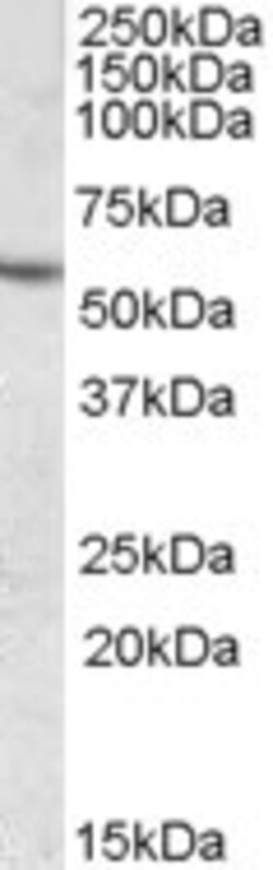 Invitrogen CES1 Polyclonal Antibody 100 &mu;g; Unconjugated:Antibodies,