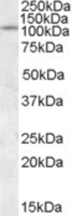Invitrogen PTPRN Polyclonal Antibody 100 &mu;g; Unconjugated:Antibodies,