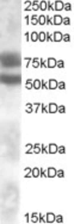 Invitrogen DACH1 Polyclonal Antibody 100 &mu;g; Unconjugated:Antibodies,