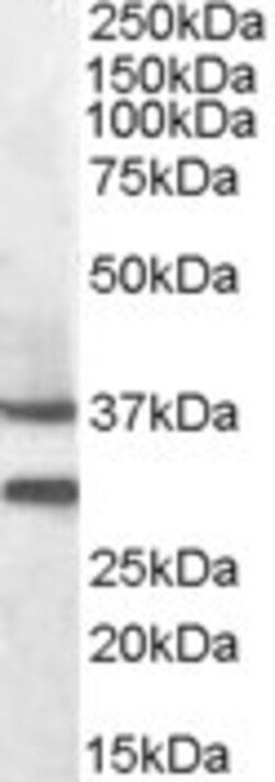 Invitrogen MC5R Polyclonal Antibody 100 &mu;g | Buy Online | Invitrogen&trade; | Fisher Scientific