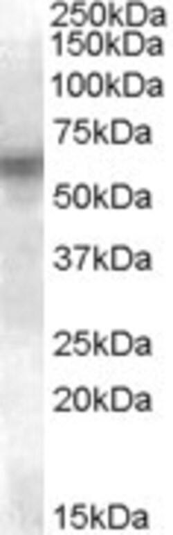Invitrogen Lyn Polyclonal Antibody 100 &mu;g; Unconjugated:Antibodies,