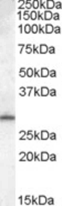 Invitrogen MTHFD2L Polyclonal Antibody 100 &mu;g; Unconjugated:Antibodies,