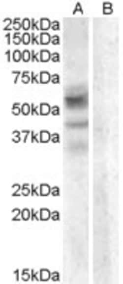 Invitrogen Arylsulfatase D Polyclonal Antibody 100 &mu;g | Buy Online | Invitrogen&trade; | Fisher Scientific
